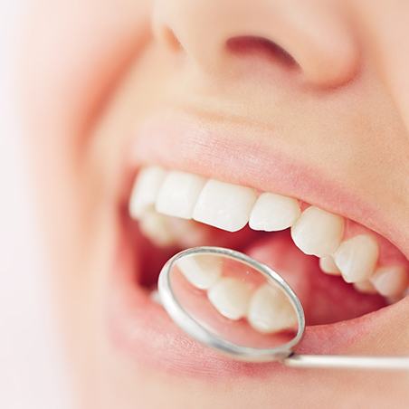 Mirror being used to show filling in patient’s mouth