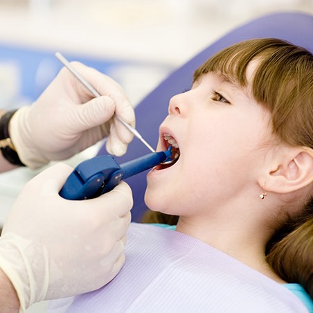 Dentist using filling gun to place tooth-colored filling