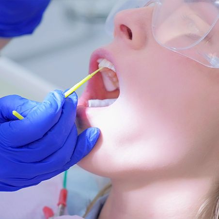 Child receiving fluoride treatment