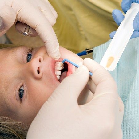 Child receiving silver diamine fluoride treatment