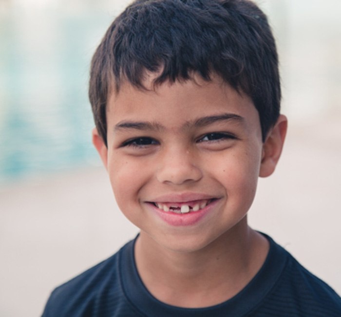 a child smiling with a missing tooth 