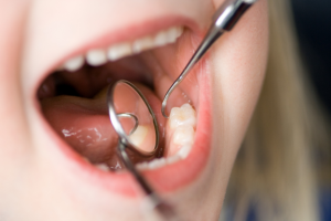 Dentist looking in young child’s mouth