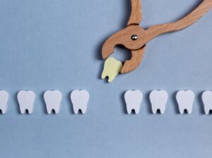 Teeth lined up with one being pulled out of order.